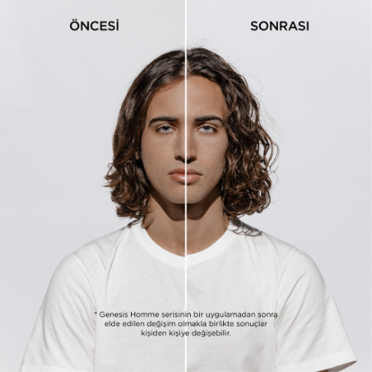 Kerastase Genesis Homme Saç Dökülme Karşıtı Güçlendirici Serum 90 ml resmi