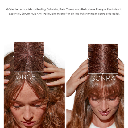 Kerastase Symbiose Kepek Karşıtı Hücresel Mikro Peeling 200 ml resmi
